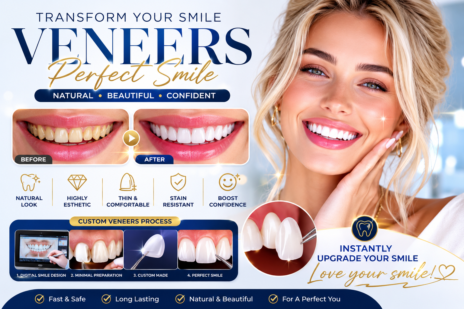 dental veneers
