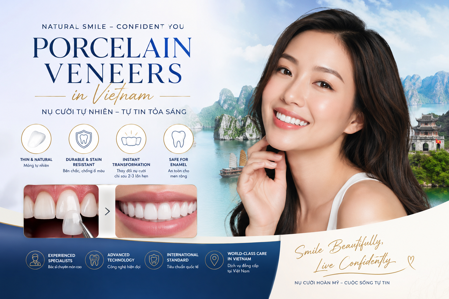 porcelain veneers in Vietnam