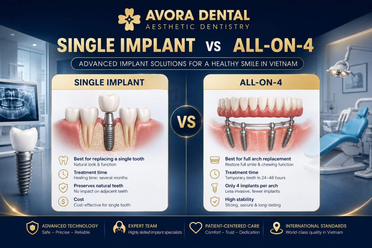 single implant vs all-on-4 in Vietnam
