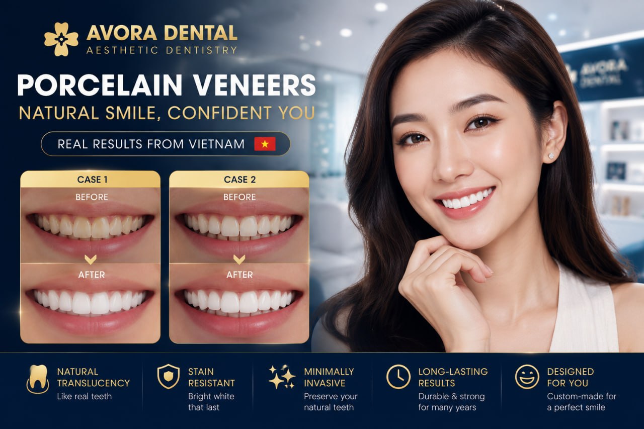 porcelain veneers in Vietnam results