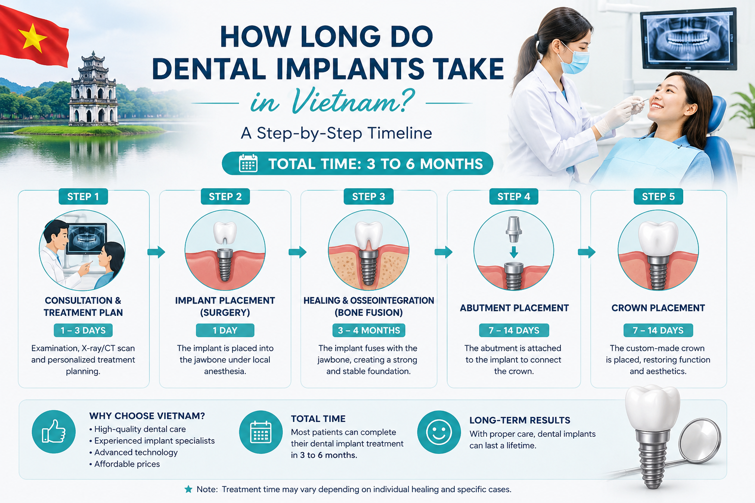 how long do dental implants take in Vietnam