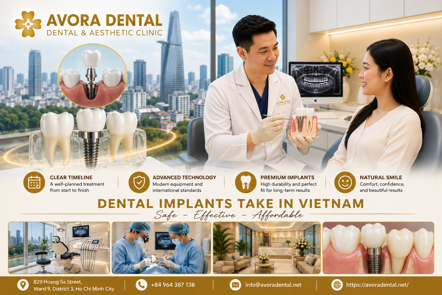 Dental Implants Take in Vietnam
